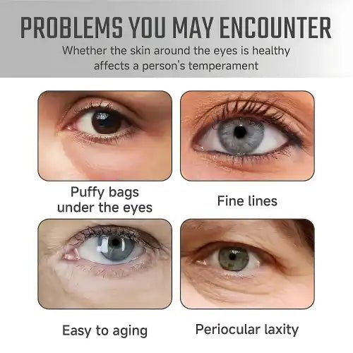 Lutein Anti - Wrinkle Serum – Firm & Radiant Skin - Trends Nest