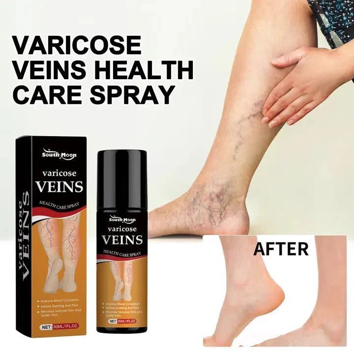 Varicose Vein Relief Spray - Trends Nest