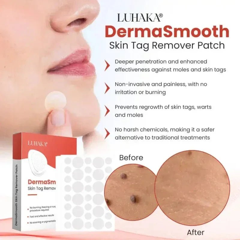 Derma Smooth Skin Tag Removal Patch - ✨ 100% Results - Trends Nest
