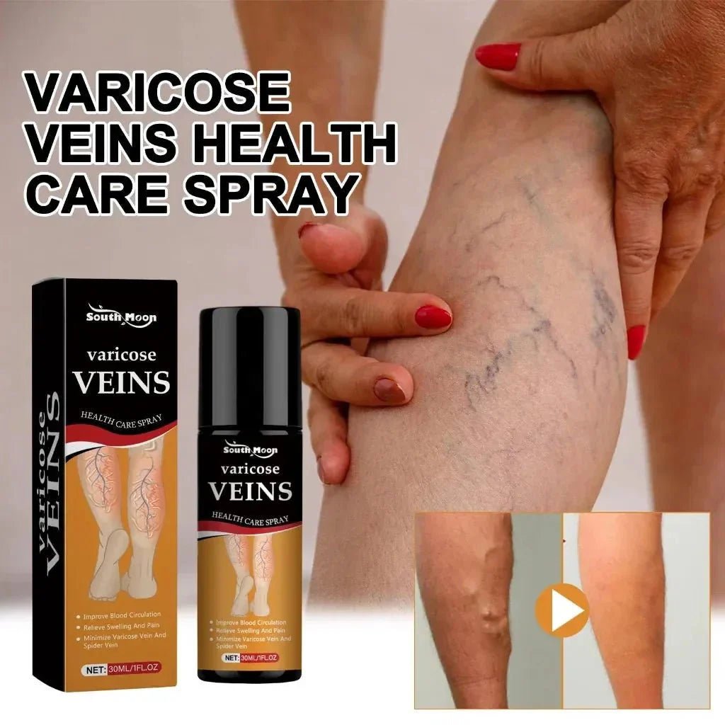 Varicose Vein Relief Spray - Trends Nest